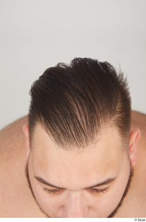 Ronaldo Biggato hair 0001.jpg